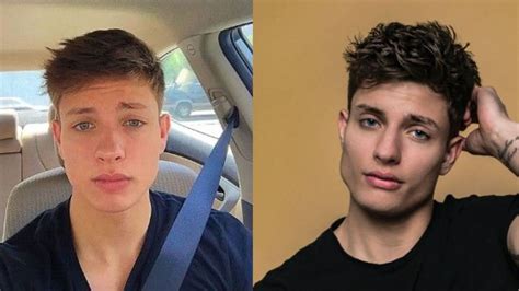 matt rife before and after plastic surgery|Matt Rife Addressed Facial Surgery Rumors From Actual Doctors